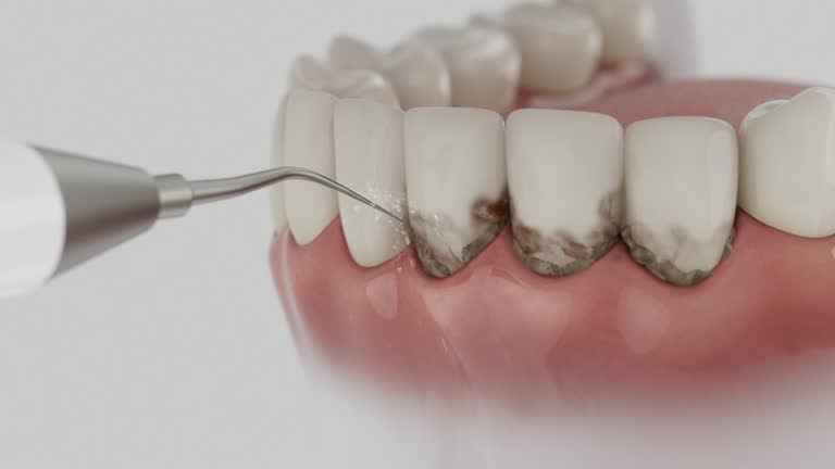 Reliable Emergency Dentist contractor in Monroeville, IN by Smile Center Dentistry